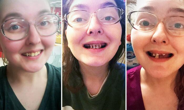 Woman Shares Scary Photos of Dental Decay in Span of 3 Years of Drinking Pop and No Brushing
