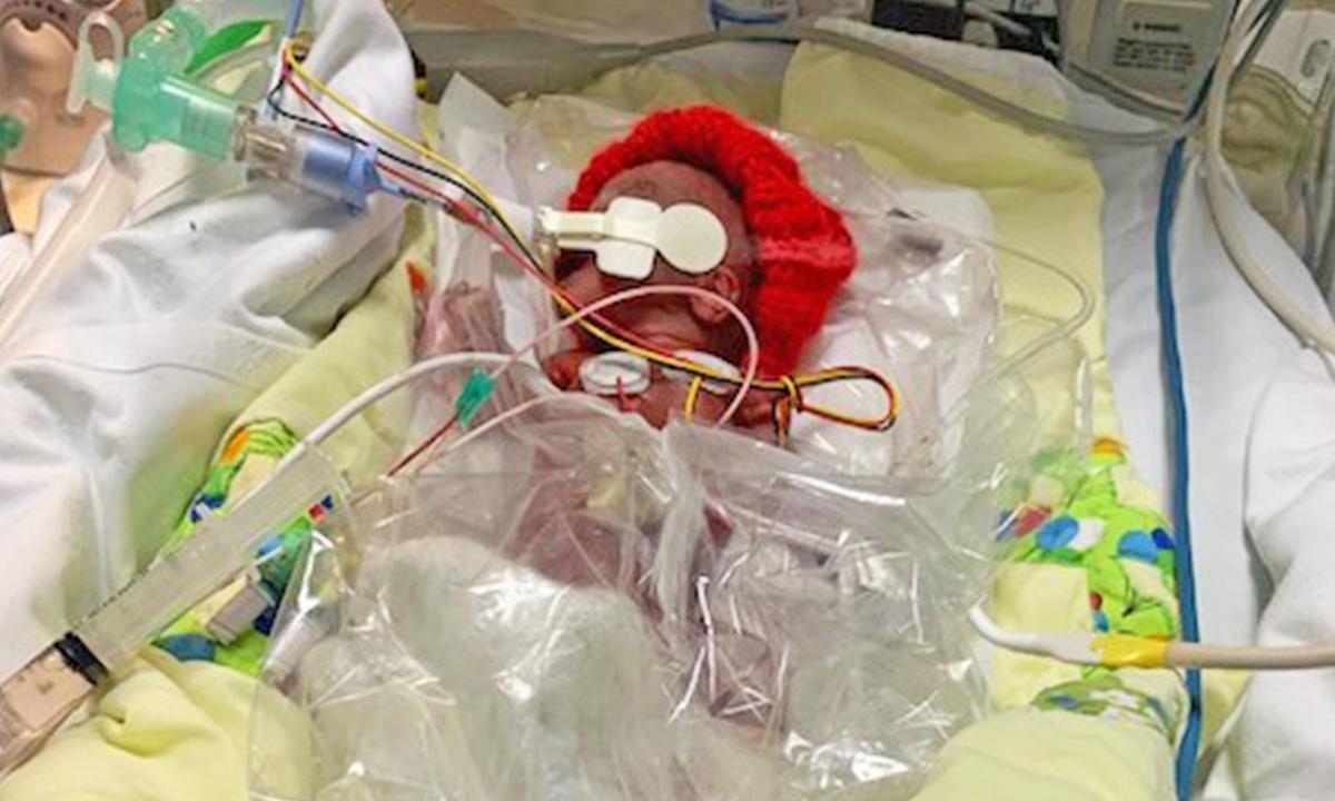 Miracle Preemie Who Was Born at 1lb 3oz Beats the Odds to Survive and Is Now 9 Months Old