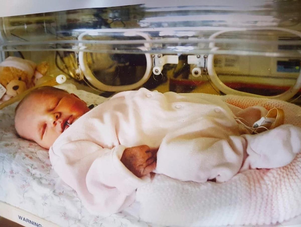 Baby Ashleigh, who was born prematurely. (Courtesy of <a href="https://www.facebook.com/alison.mulvaney.5">Alison Mulvaney</a>)