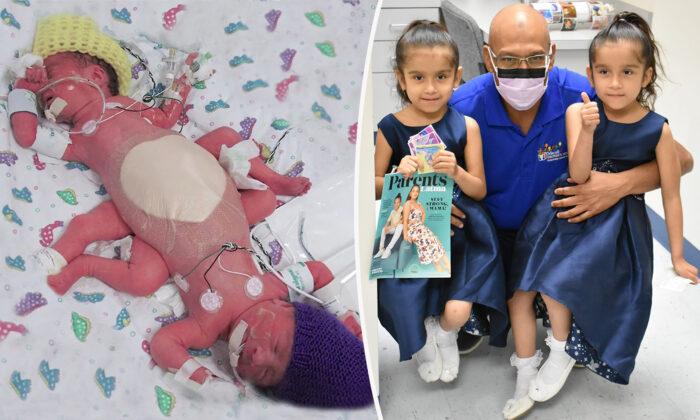 Formerly Conjoined Twins Thriving 5 Years After Separation Reunite With Hospital Family to Celebrate