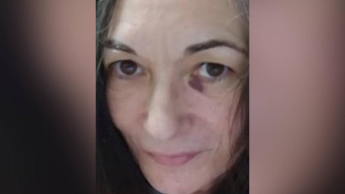 First Photo of Ghislaine Maxwell From Jail Shows Unexplained Black Eye