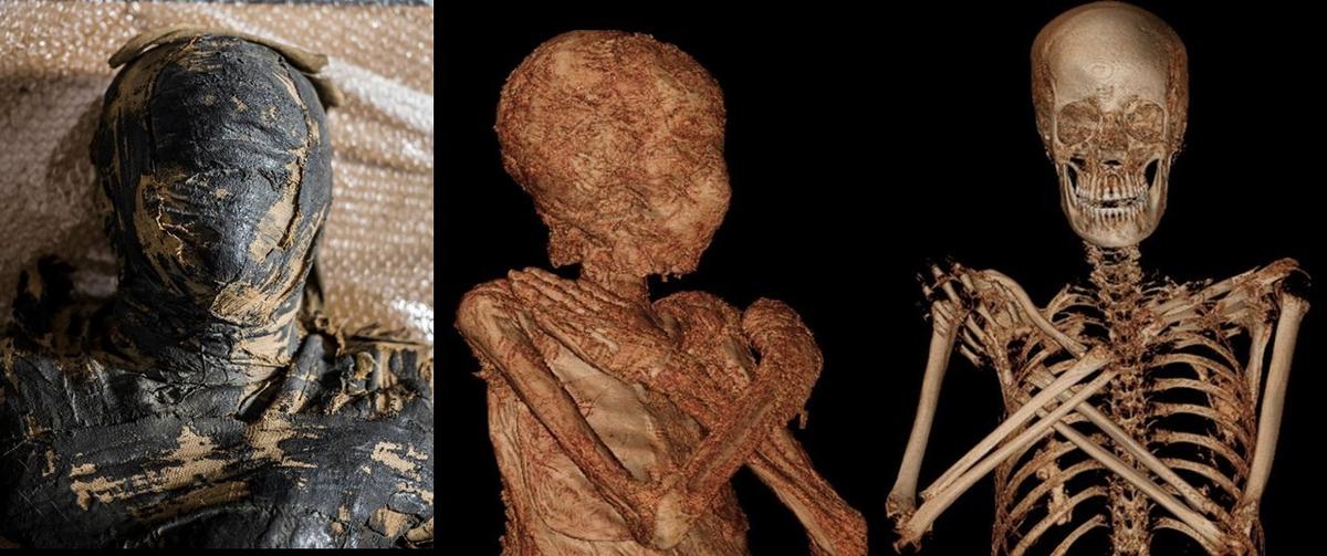 More scanned images of the mummy show her bones and remaining tissue. (Courtesy of <a href="http://warsawmummyproject.com/en">Warsaw Mummy Project</a>)