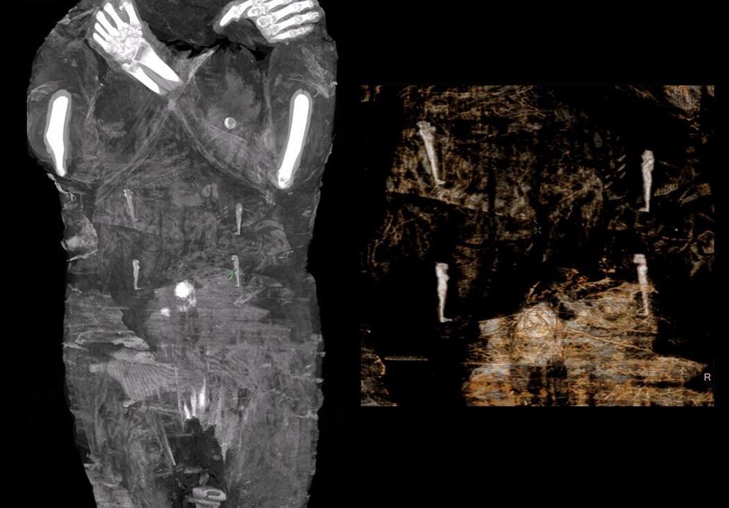 A scan showing the amulets wrapped on the woman's person. (Courtesy of <a href="http://warsawmummyproject.com/en">Warsaw Mummy Project</a>)
