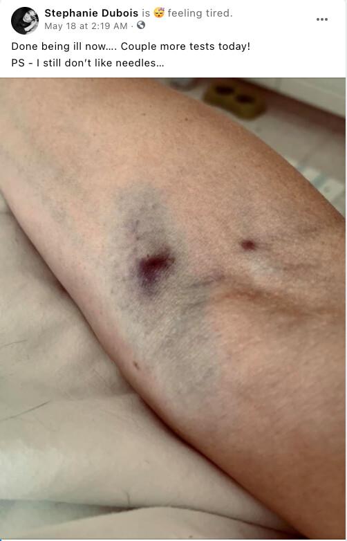 A photo of Stephanie Dubois's arm. (Stephanie Dubois/Facebook)
