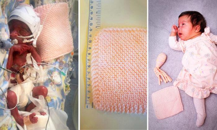 Mom Shares Startling Before and After Photos of Preemie With Favorite Blankie—Now Thriving