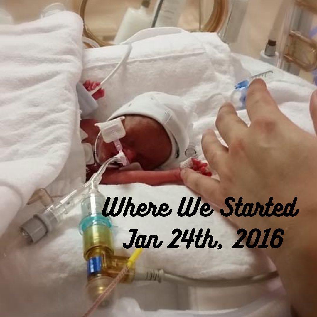 Baby Tru Wende Beare in an NICU incubator in January 2016. (Courtesy of <a href="https://www.instagram.com/robbeare/">Rob</a> and <a href="https://www.instagram.com/chantal_beare/">Chantal</a> Beare)