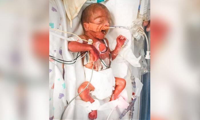 Baby Born Size of Sharpie Defies Incredible Odds of Survival; 4.5 Months Later, He’s a 7-Pound Miracle