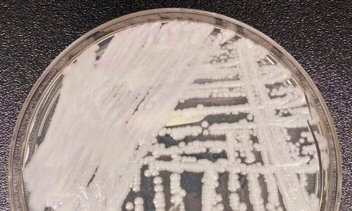 ‘Superbug’ Fungus Spread in Two Cities, Health Officials Say
