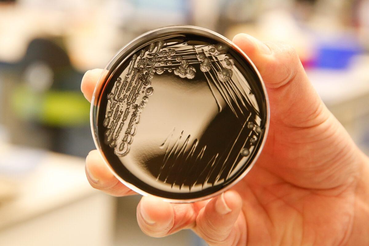 A culture of the Legionella bacteria is seen at a hospital in Ghent, Belgium, on May 17, 2019. (Nicolas Maeterlinck/AFP/Getty Images)