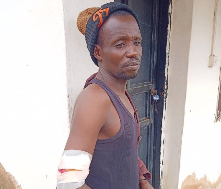 Pastor Adamu Musa, shot during a terrorist attack in Jebbu Miango, Plateau State, Nigeria. (Lawrence Zongo/The Epoch Times)