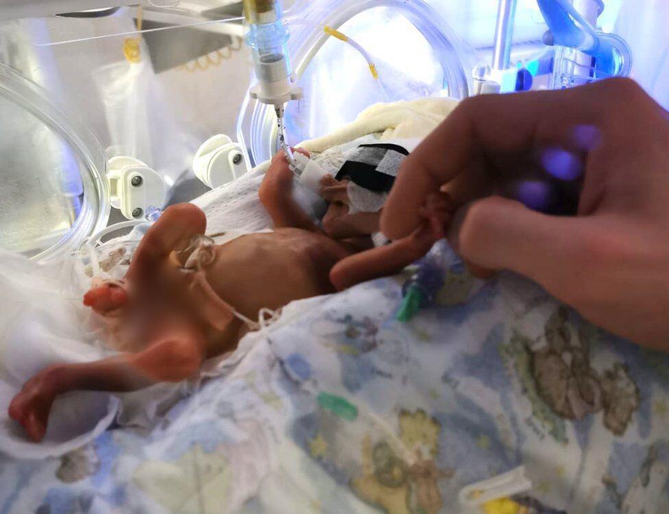 Baby Sofia in an NICU incubator at University Hospital Wishaw in North Lanarkshire. (Courtesy of <a href="https://www.facebook.com/inbi4">Inars Birina</a>)