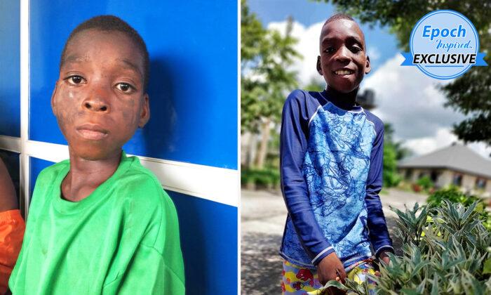 Naked Boy Found on the Street Tortured, Extremely Malnourished is Rescued and is Now Thriving