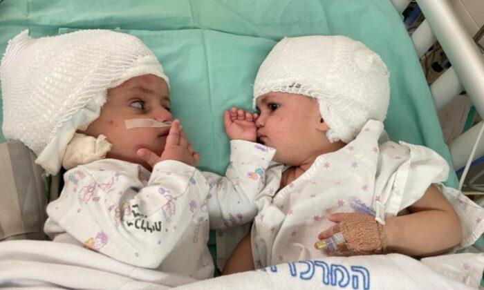 1-Year-Old Conjoined Twins Separated in Israel