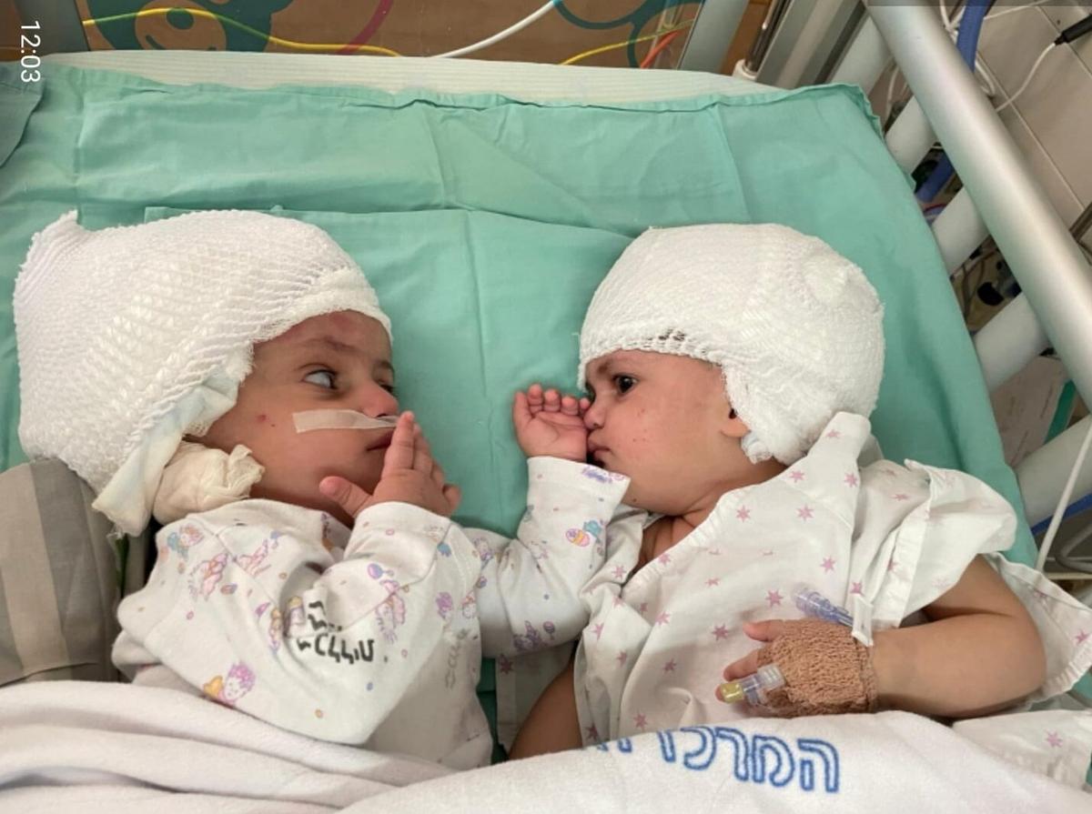 Formerly siamese Israeli twins look at one another after having undergone rare separation surgery at Soroka Medical Centre, Beersheba September 5, 2021. The one-year-old girls, whose names were not released to media, were born with the rear parts of their heads conjoined. (Soroka Medical Centre/Handout via REUTERS)