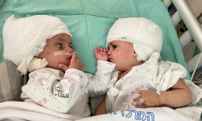 Twins Who Were Conjoined at the Head Are Successfully Separated After a 12-Hour Surgery