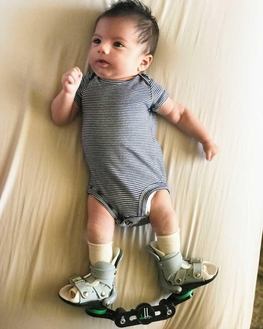 Baby Tobias has to wear his medical shoes for 14 hours a day. (Courtesy of <a href="https://www.facebook.com/Tobiass-Journey-2637133076510838/">Eliza Moody</a>)