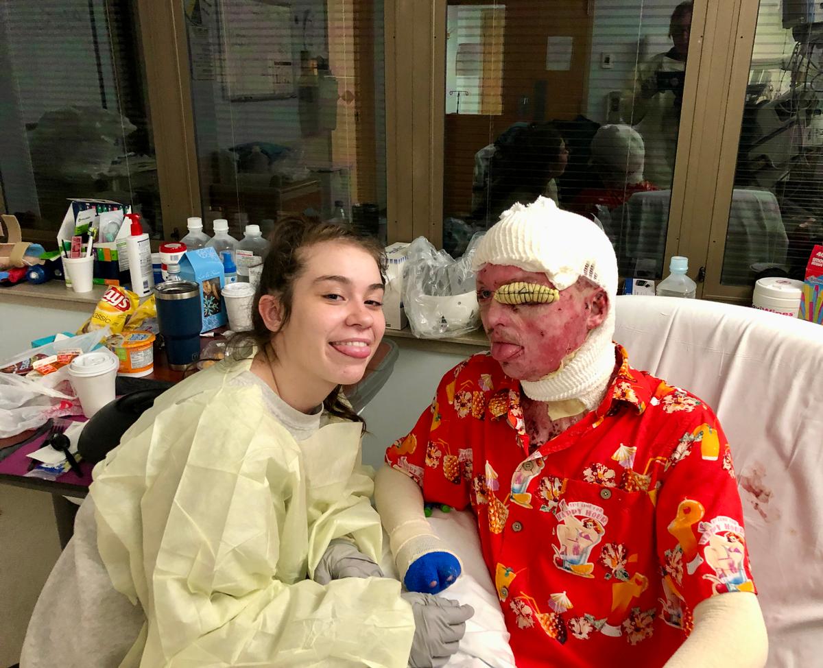 Zach suffered third-degree burns over 68 percent of his body in the campus fire. (Courtesy of <a href="https://www.instagram.com/zacharyrecovery/">Deona Jo Sutterfield</a>)