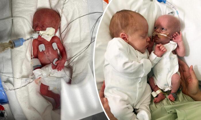 Parents Say Preemie Born Weighing 1lb Keeps ‘Fighting’ Due to Cuddles From Identical Twin