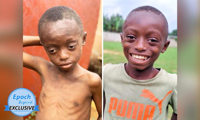 Severely Beaten and Left Alone to Die, Boy Becomes ‘Happiest Child’ After Rescue and Rehab