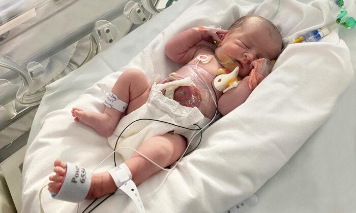 Baby Born With Her Intestines on the Outside Now Has an Outie Bellybutton and Is Thriving