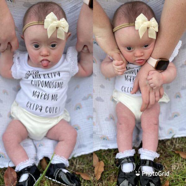 Arlee Grace was diagnosed with Down syndrome. (Courtesy of <a href="https://www.facebook.com/zoeylea.usher">Zoey-Lea O’Hehir</a>)