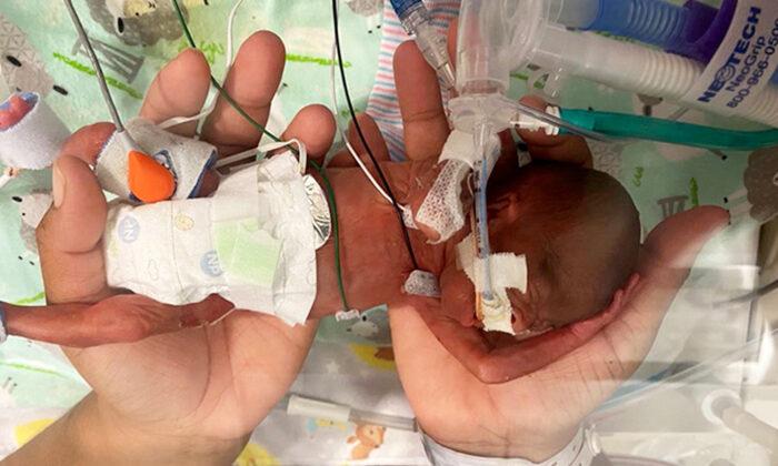 Boy With Less Than 1 Percent Survival Odds Breaks Record as World’s Most Premature Baby