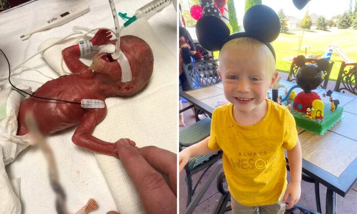 Less-Than-1lb Preemie Born a Week Before the Abortion Limit Defies the Odds to Thrive