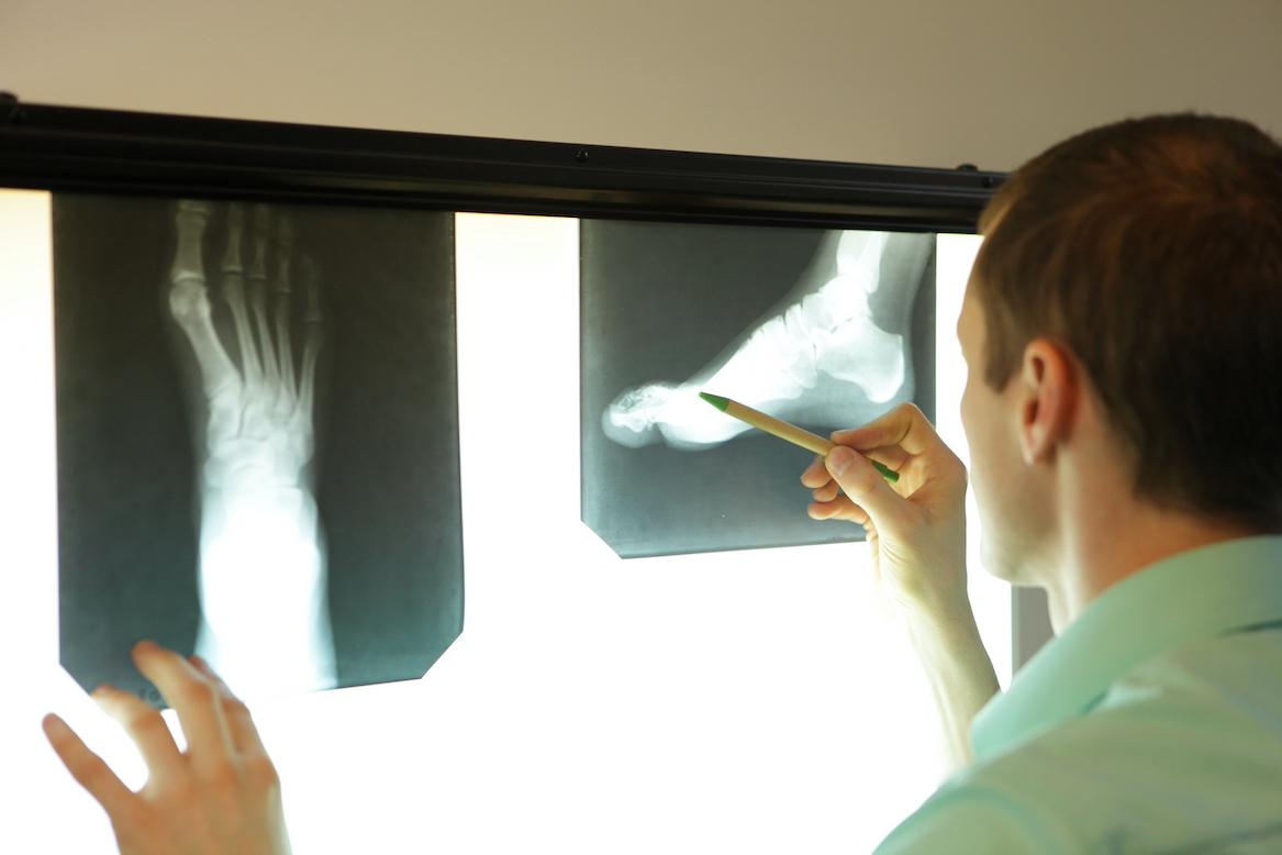 The Sometimes Strange History of the X-Ray