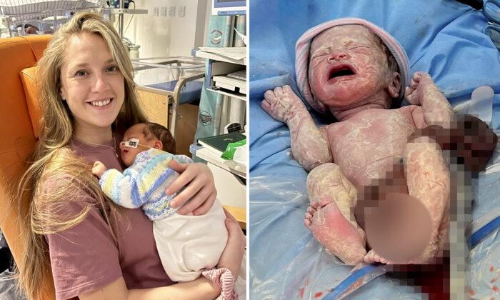 Mom Left in Shock After Her Baby Was Born With Organs Outside His Body Due to a Rare Condition