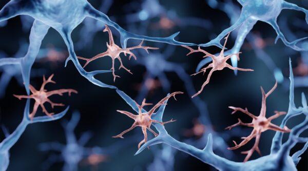 Microglia are immune cells in the brain, <span class="caption">In healthy states, they use their arms to test the environment. During an immune response, microglia change shape to engulf pathogens. But they can also damage neurons and their connections that store memory.</span> By ART-ur/Shutterstock