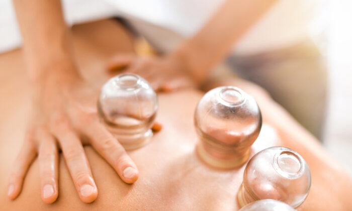 Cupping Treatments and Olympic Athletes