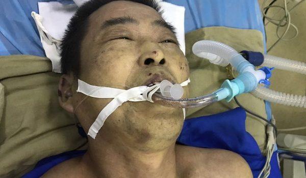 Falun Gong practitioner Yang Yuyong passed away on July 11, 2017, after eight months in detention for his spiritual beliefs. His body was covered with wounds and bruises. (Courtesy of Huang Hanzhong)