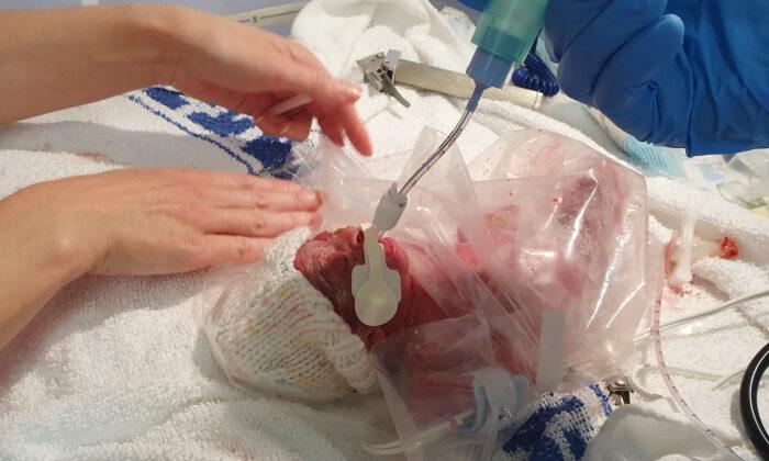Preemie Born at 26 Weeks Was Put Into a Sandwich Bag, Defies Odds, and Is Now Thriving