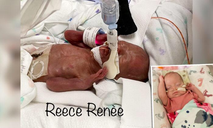 Mom Born With Double Uterus Delivers Hospital’s Youngest Surviving Baby at 22 Weeks