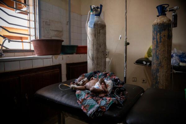 A malnourished baby is cared for in the pediatric department of Boulmiougou hospital in Ouagadougou, Burkina Faso, on April 15, 2022. (Sophie Garcia/AP Photo)