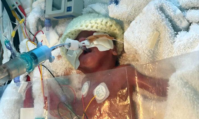 Baby Born 17 Weeks Early Survives After His Parents Refused Twice to Turn Off His Life Support