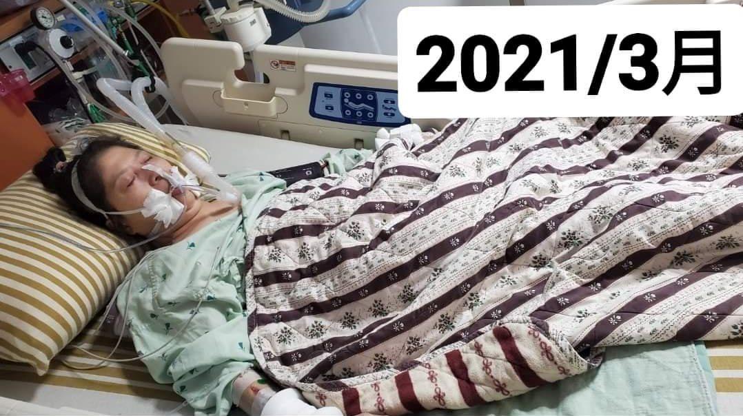 Jung-Hua Chen is intubated in the hospital in March 2021. (Courtesy of Daniel)