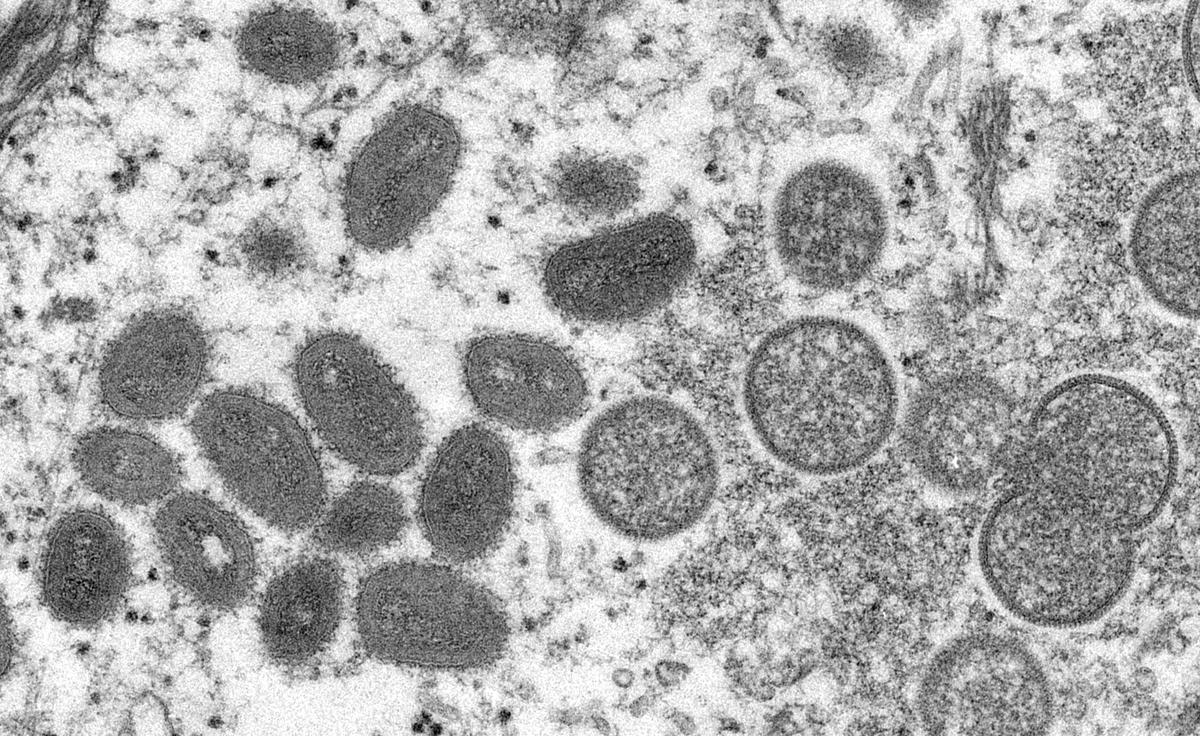 An electron microscopic (EM) image shows mature, oval-shaped monkeypox virus particles as well as crescents and spherical particles of immature virions, obtained from a clinical human skin sample associated with the 2003 prairie dog outbreak in this undated image obtained by Reuters on May 18, 2022. (Cynthia S. Goldsmith, Russell Regnery/CDC/Handout via Reuters)
