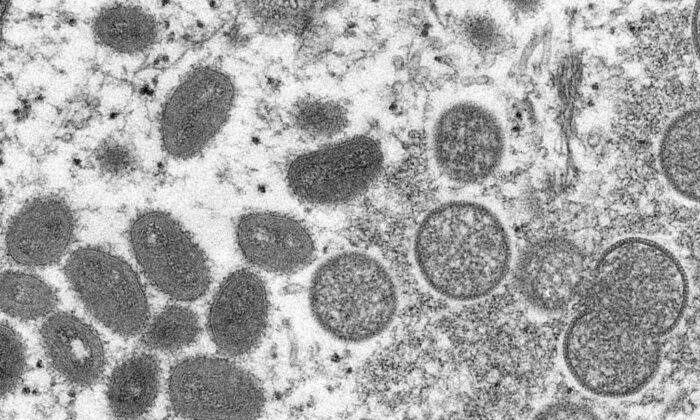 Toronto Health Authorities Investigate First Suspected Monkeypox Case