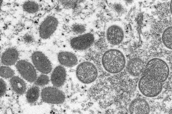 In a file electron microscope image, Monkeypox virions, left, in a sample of human skin. (Cynthia S. Goldsmith, Russell Regner/CDC via AP)