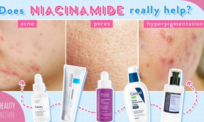 Niacinamide and Panthenol for Reducing Large Pores, Hyperpigmentation, Acne, and More!