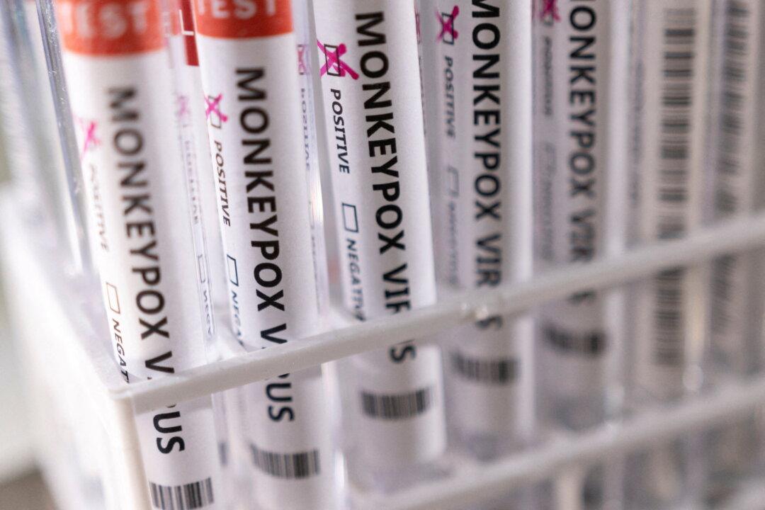 San Diego County Declares Monkeypox Emergency, Following State Lead