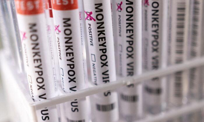San Diego County Declares Monkeypox Emergency, Following State Lead