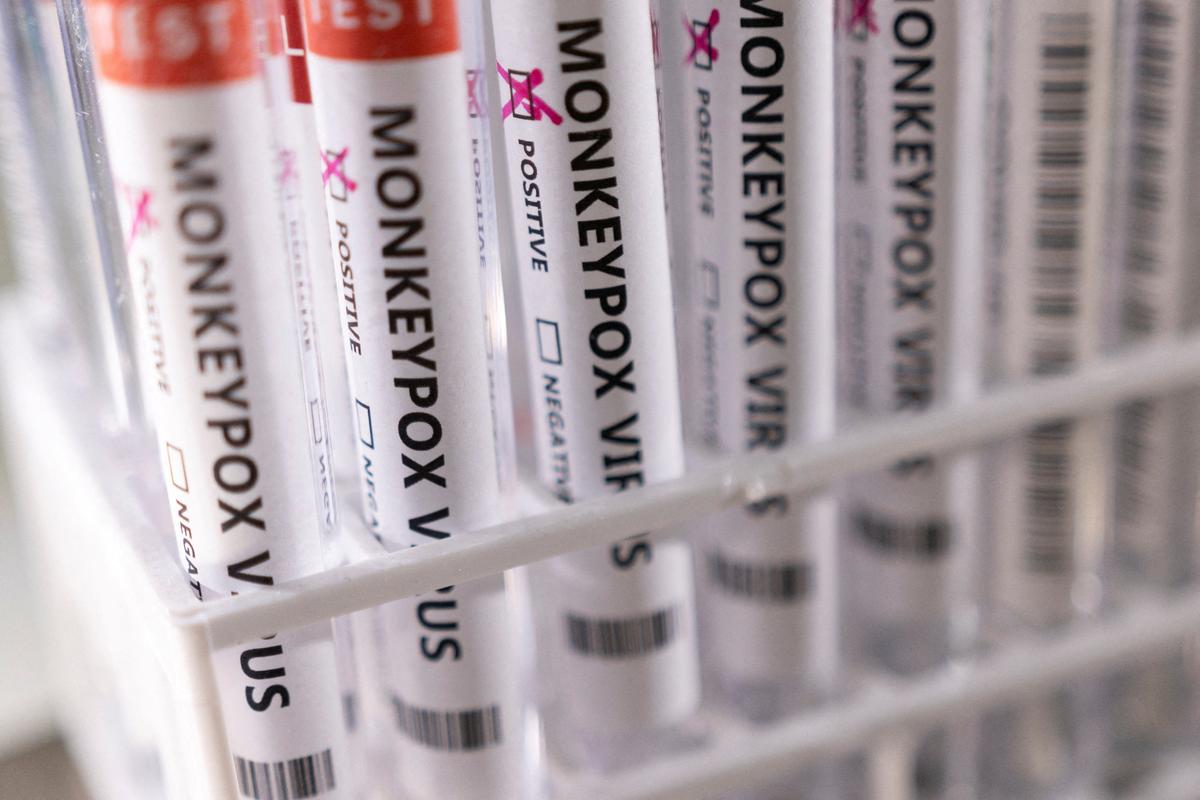 San Diego County Declares Monkeypox Emergency, Following State Lead