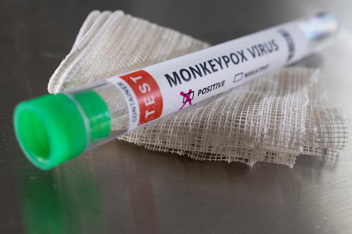 Orange County Reports First Monkeypox Case in Person Under 18