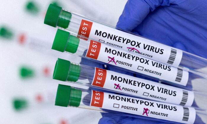 California Announces Fifth Case of Pediatric Monkeypox in US