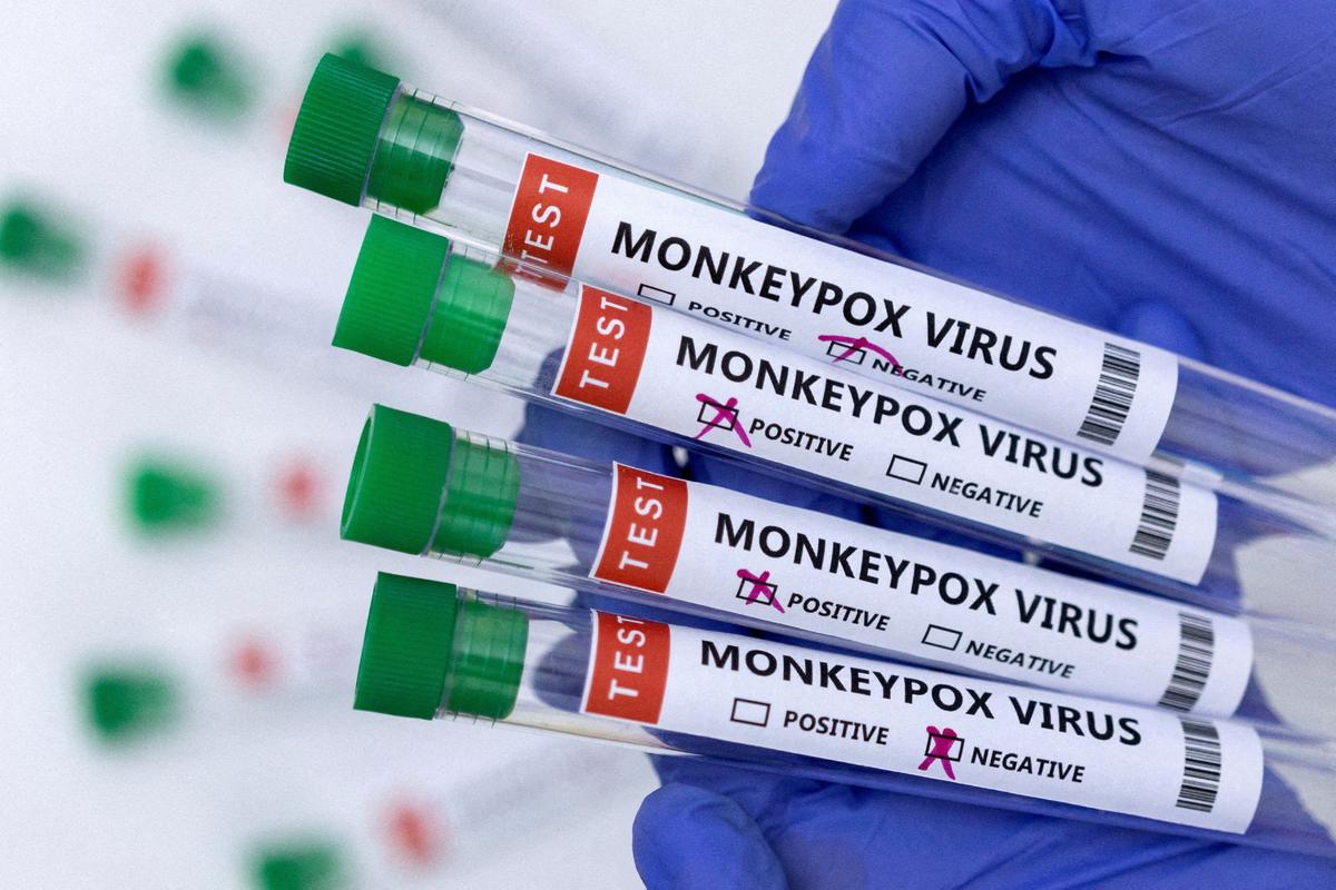 California Announces Fifth Case of Pediatric Monkeypox in US