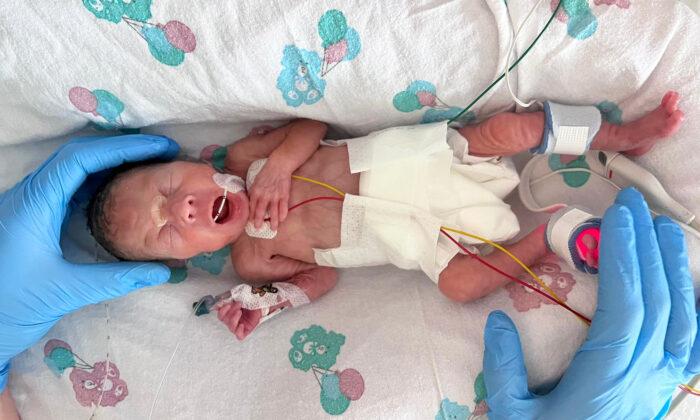 Mom Says Her Preemie Born 14 Weeks Early Is an ‘Absolute Miracle and Complete Perfection’