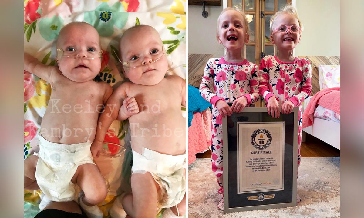World Record-Holding 'Most Premature Twins' Are Now Happy, Thriving 3-Year-Olds