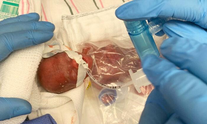 Baby Born at 11 Ounces Smallest to Survive in Hospital’s NICU, Finally Heads Home